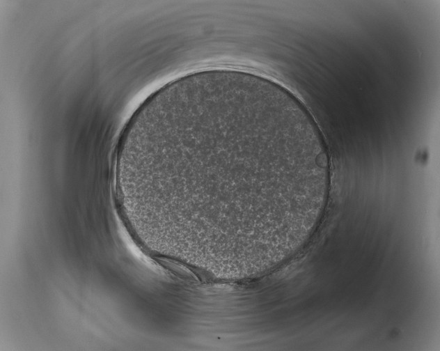 X0000114201515200911200947