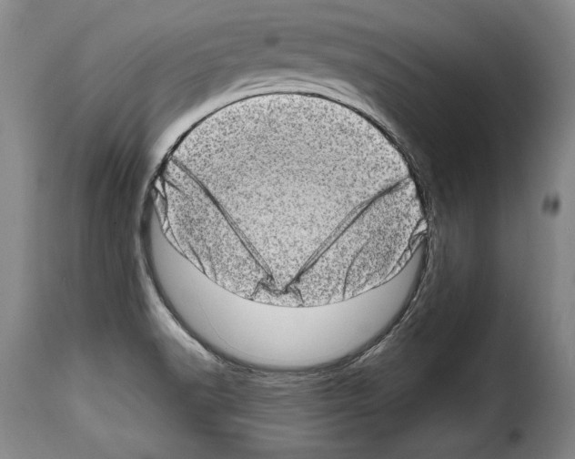 X0000114201518200911200947