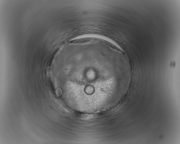 X0000114210135200910231415