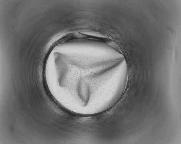 X0000114210054200911061454