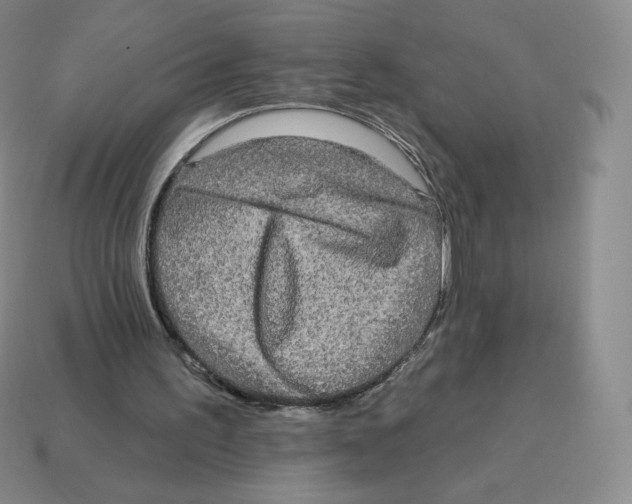 X0000114210195200911061452