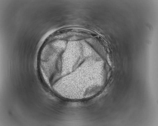 X0000114210200200911061452
