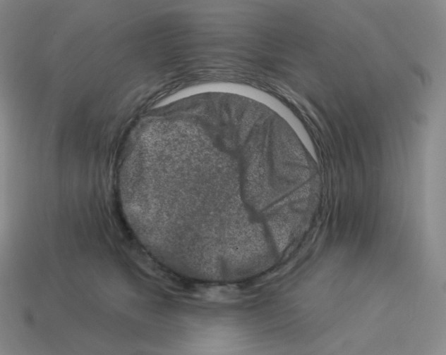 X0000114210517200911061448