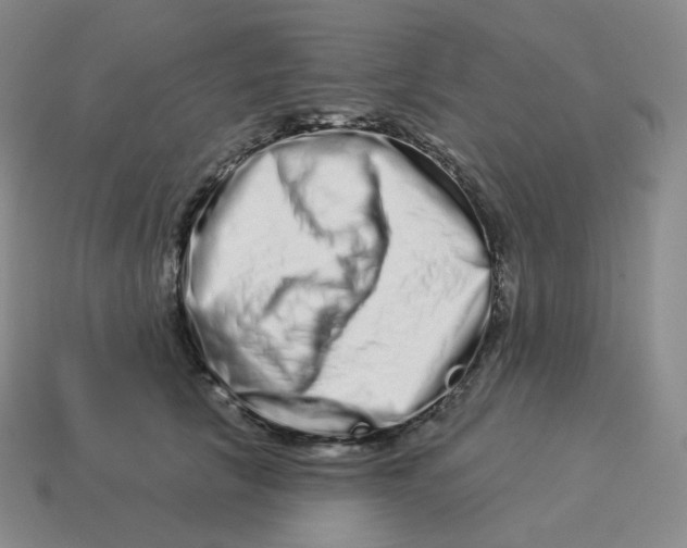 X0000114210657200911061446