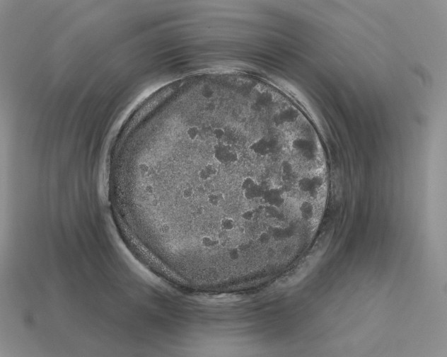 X0000114210851200911061444