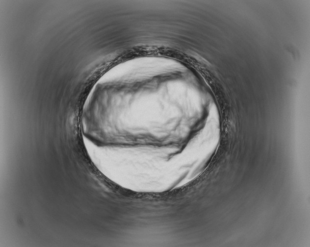 X0000114211014200911061440