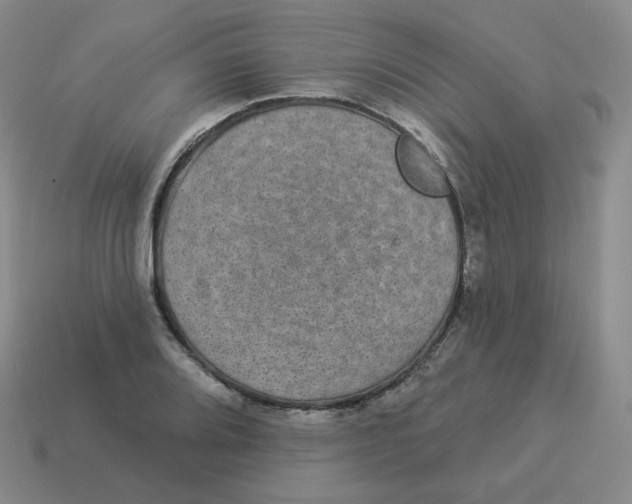 X0000114211080200911061440