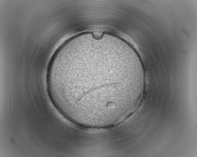 X0000114211091200911061440