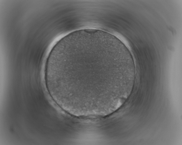 X0000114211104200911061440