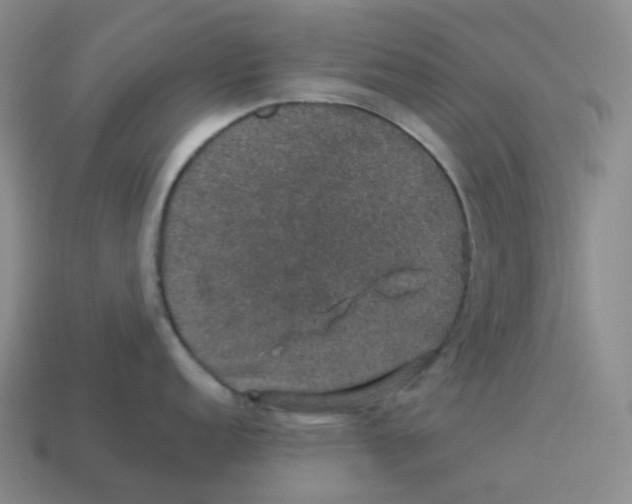 X0000114211152200911061440