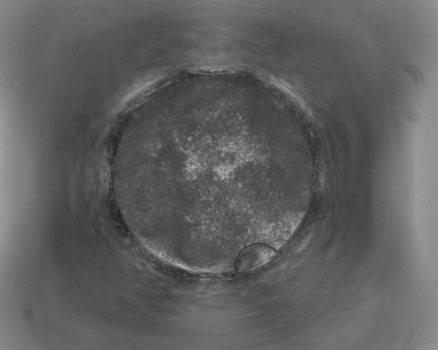 X0000114211350200911061436