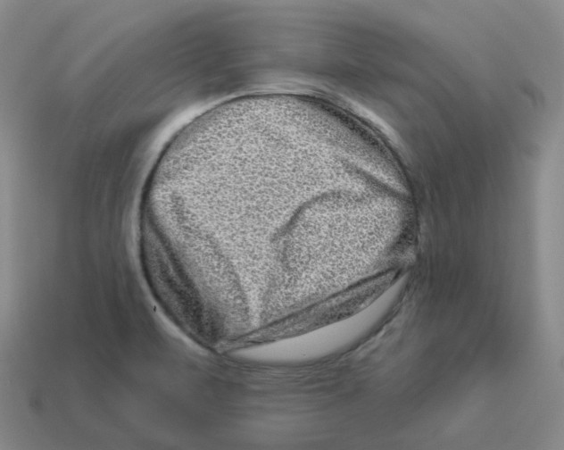 X0000114211471200911061435