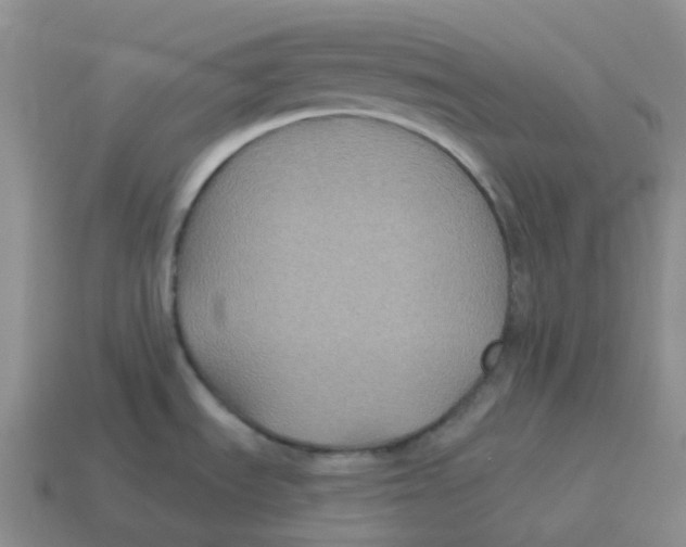 X0000114211535200911061435