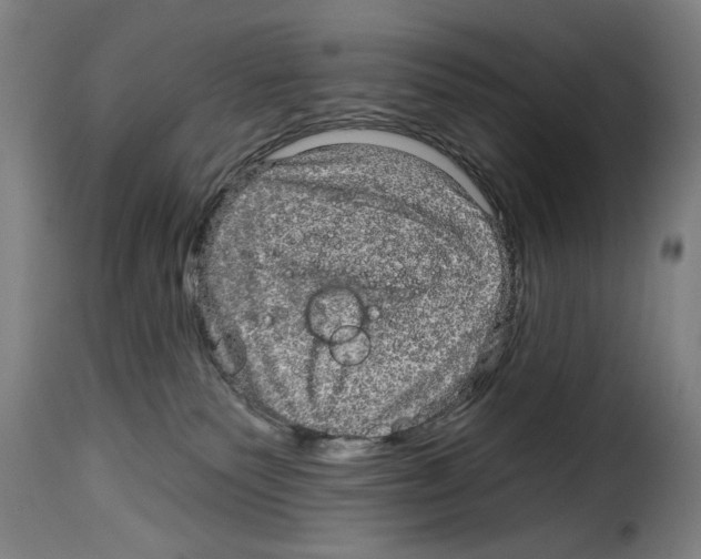 X0000114210135200911201031