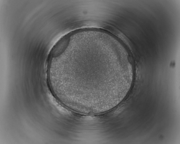 X0000114211124200911201016