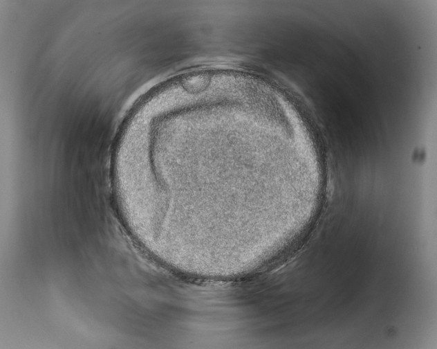 X0000114211174200911201016