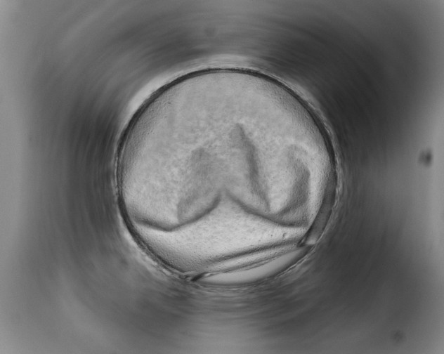 X0000114211342200911201014