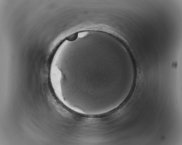 X0000114211506200911201011