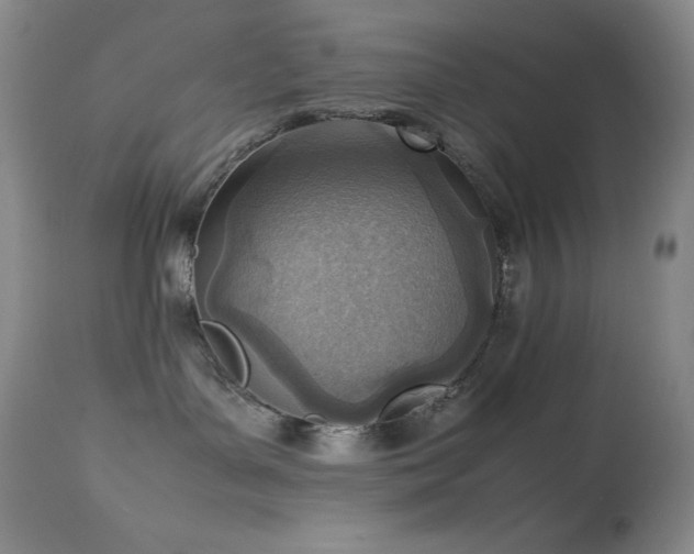 X0000114220143200910091356