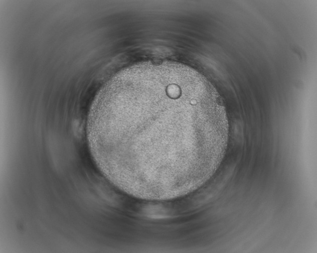 X0000114220177200911061515