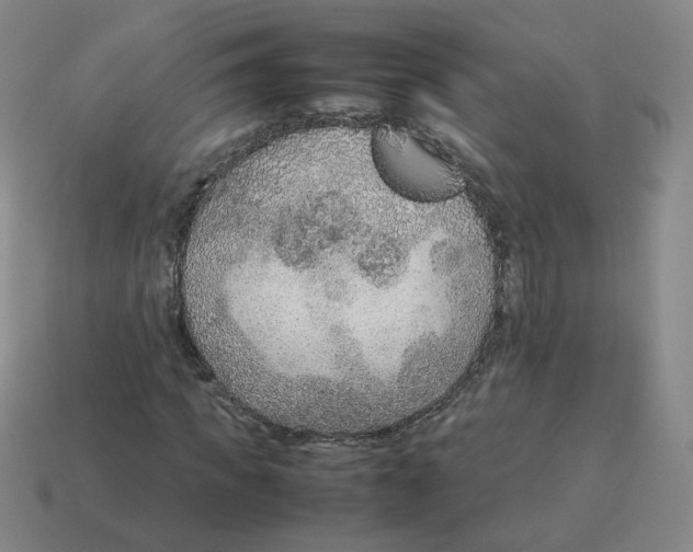 X0000114220917200911061503