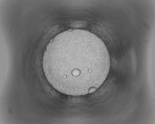 X0000114221393200911061457