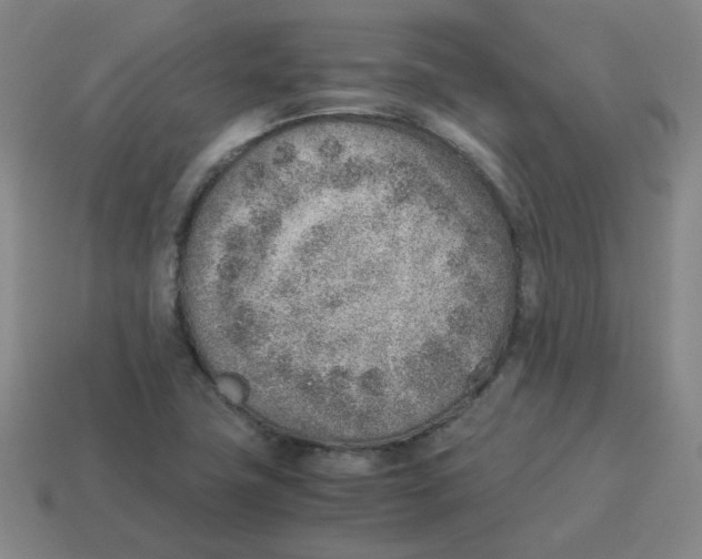 X0000114221411200911061457