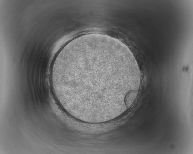 X0000114220006200911201057