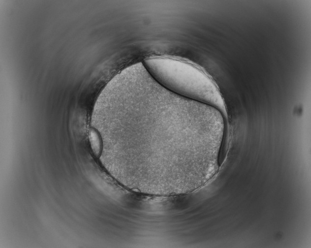 X0000114220186200911201055