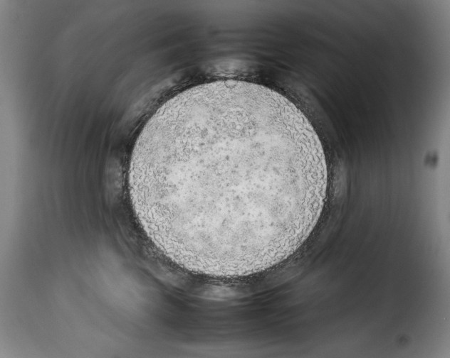 X0000114220569200911201048