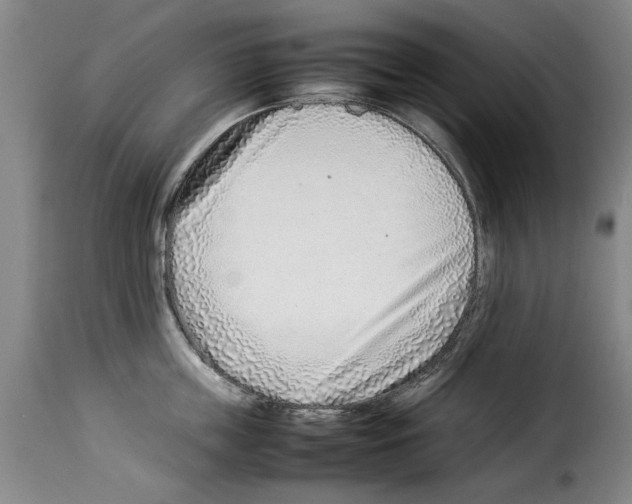X0000114220859200911201044