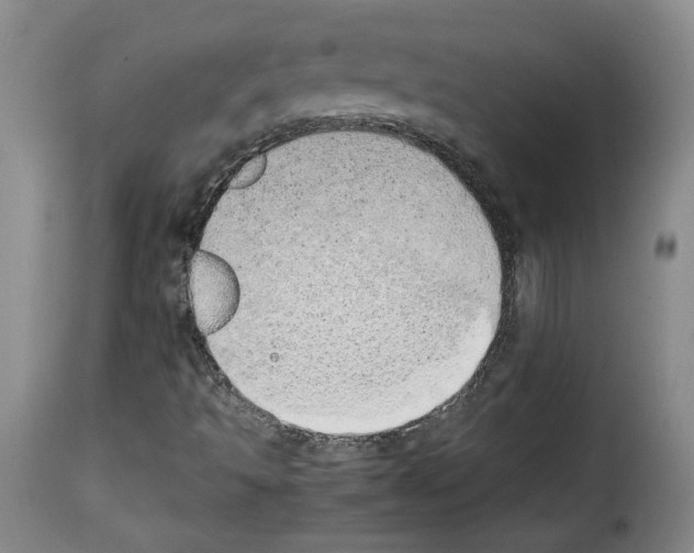 X0000114221493200911201033