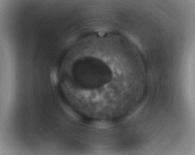 X0000114390069200910231025