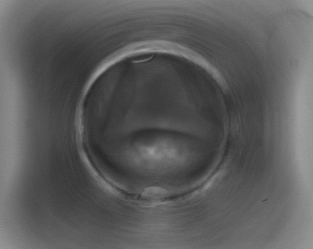 X0000114391522200910231006