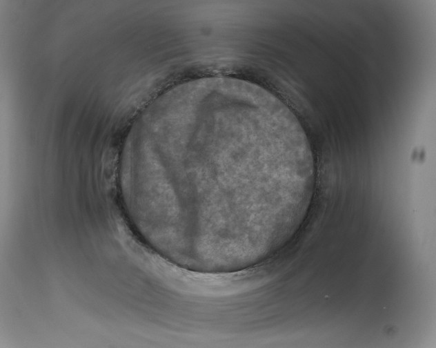 X0000114390030200911061525