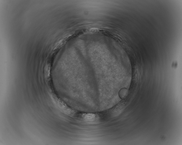 X0000114390230200911061522