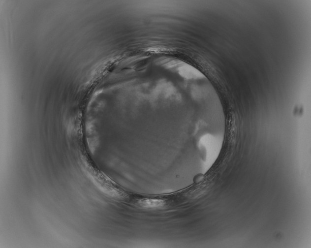 X0000114390361200911061520