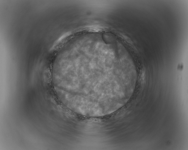 X0000114391446200911061504