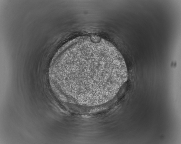 X0000114401009200911131401