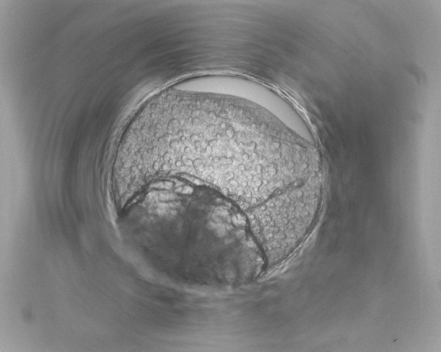 X0000114400145200911271523