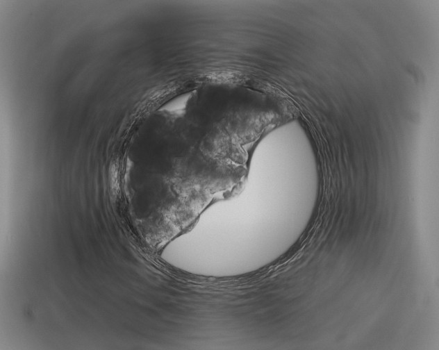 X0000114411106200910161025