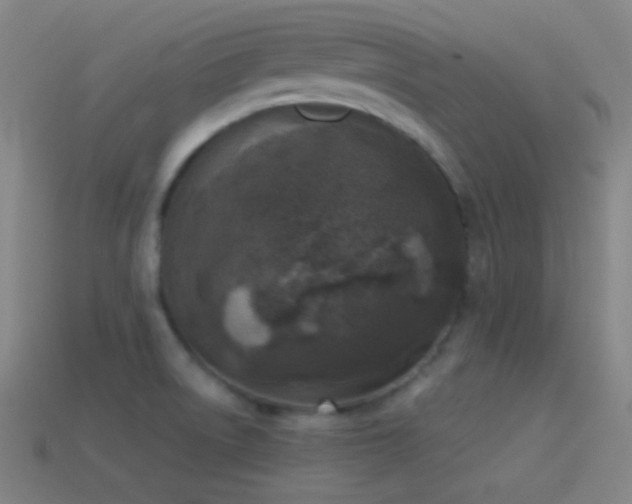 X0000114411522200910161155