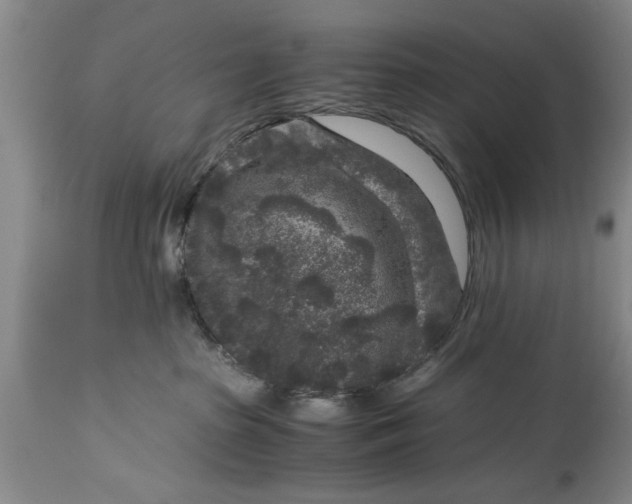 X0000114410285200911061609