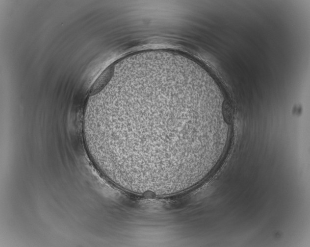 X0000114411185200911061553