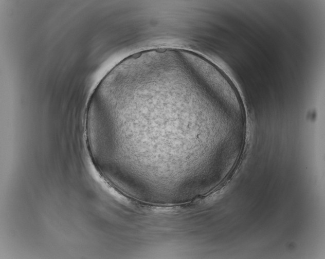 X0000114411389200911061550