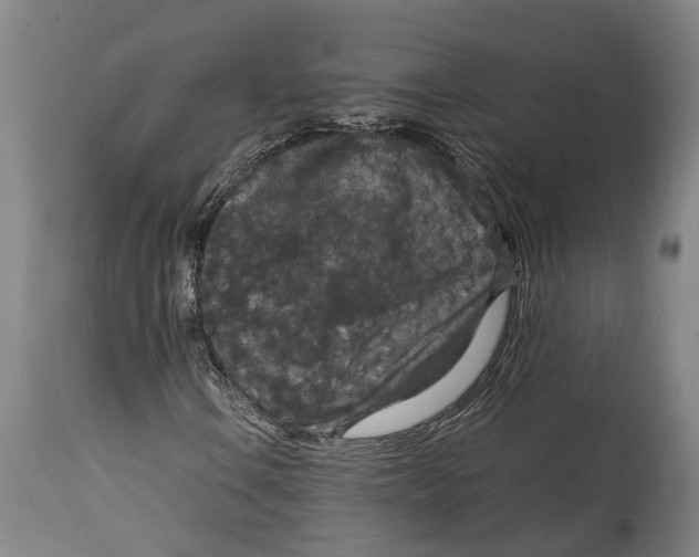 X0000114411106200911131422