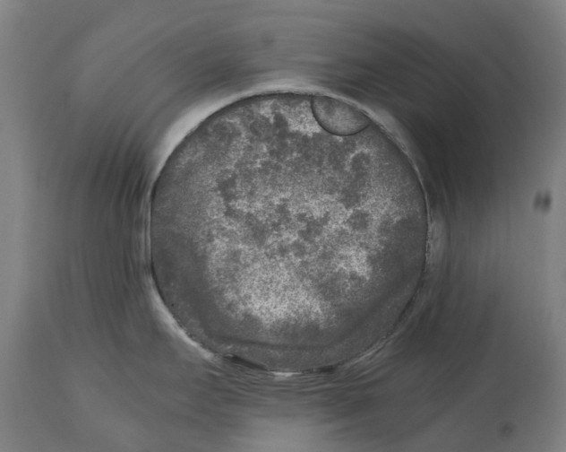 X0000114411295200911131420