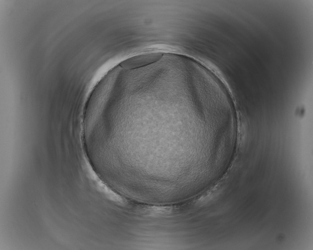 X0000114411381200911131418