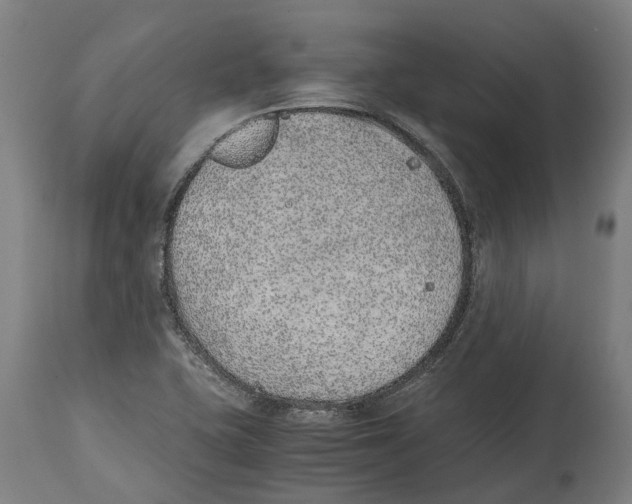 X0000114411415200911131418