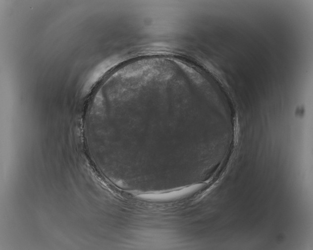 X0000114411453200911131417